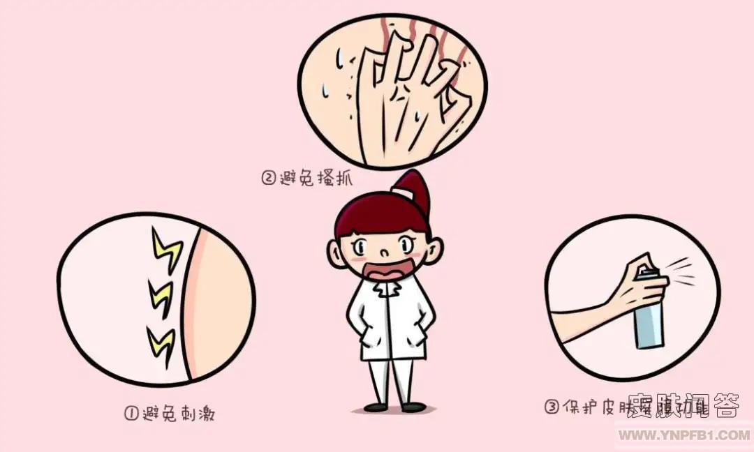 神经性皮炎